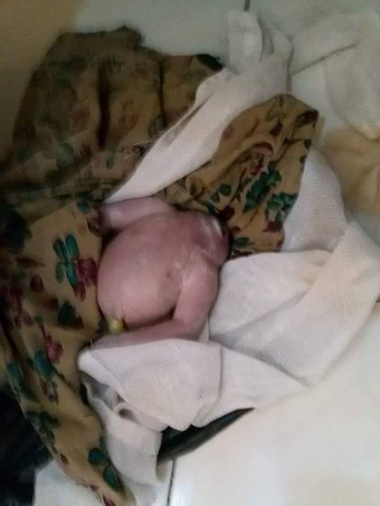 له‌ گه‌رمیان منداڵێكی بێ سه‌ر له‌ دایك ده‌بێت